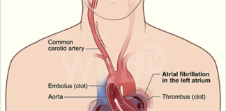 Malattie cardiovascolari: il 12 settembre a Ravenna uno screening per la prevenzione