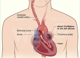Malattie cardiovascolari: il 12 settembre a Ravenna uno screening per la prevenzione