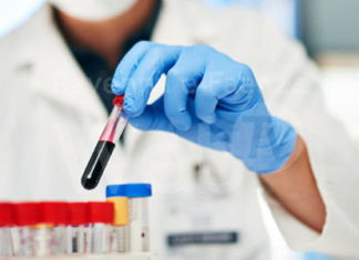 Un convegno a Ravenna per fare il punto sull’attività e ricerca dell’Ematologia in Romagna