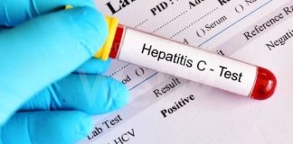 Ausl Romagna: parte la campagna di screening delle infezioni da virus Epatite C (HCV)