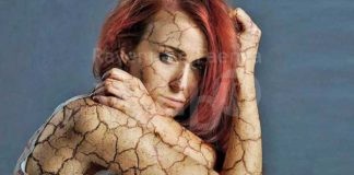 Fdi: un sistema integrato per i malati di fibromialgia