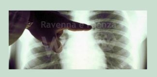 Ravenna in Comune, smog: Aumentano tumori e malattie