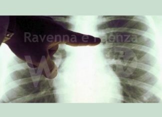 Conselice: le iniziative per la campagna di sensibilizzazione al cancro al polmone