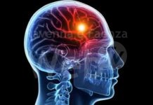 ANAP Ravenna organizza l’evento “La Prevenzione dell’Ictus”