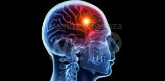 ANAP Ravenna organizza l’evento “La Prevenzione dell’Ictus”