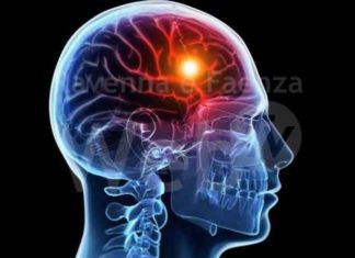 ANAP Ravenna organizza l’evento “La Prevenzione dell’Ictus”