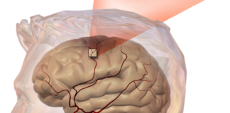 A Russi arriva la prevenzione all’ictus cerebrale con screening gratuiti alla Casa della Salute