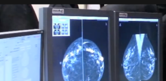 Tumori: in Emilia-Romagna 19 mila vite salvate con screening e cure