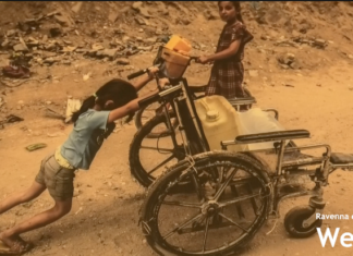 La vita a Gaza sotto i bombardamenti. Inaugurata la mostra: “10 mila bambini hanno subito amputazioni”