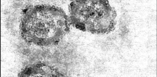 Screening per l’Epatite C: trovati 1.032 positivi in Emilia-Romagna