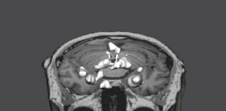 L’abbondanza e la scarsità di cibo in un’installazione artistica al MIC