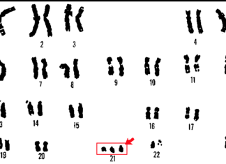 Pranzo di beneficenza per finanziare la ricerca scientifica sulla sindrome di Down